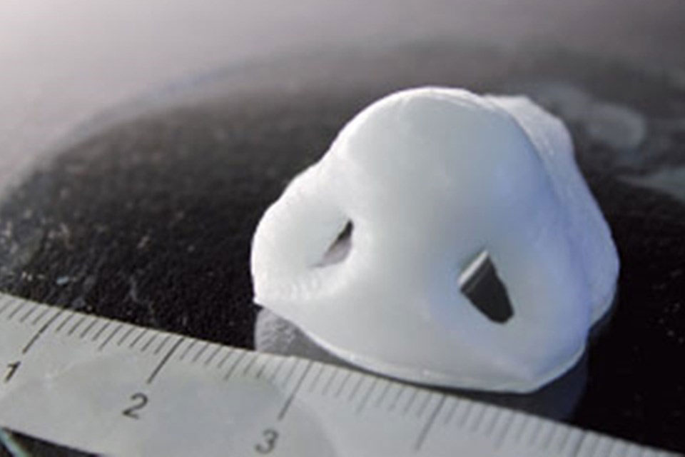Imagem de Cartilagem de nariz feita por impressora 3D é capaz de 'crescer' no rosto no site TecMundo
