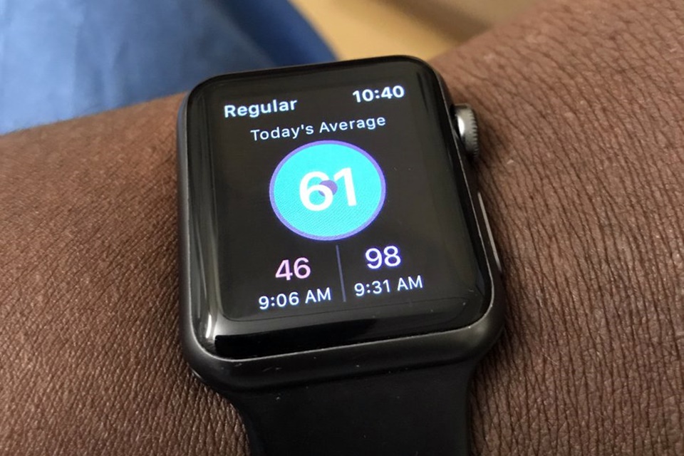Imagem de Apple Watch salva a vida de americano ao detectar embolia pulmonar no tecmundo