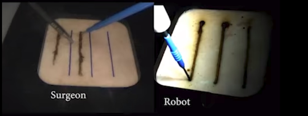 Robô cirurgia